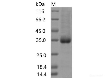 Recombinant SARS-CoV-2 Spike RBD(S477I)(His Tag), Cell Assays, Elabscience Biotechnology, MSE Supplies