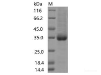 Recombinant SARS-CoV-2 Spike RBD(S477I)(His Tag), Cell Assays, Elabscience Biotechnology, MSE Supplies