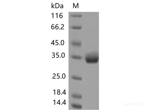 Recombinant SARS-CoV-2 Spike RBD(S477N)(His Tag), Cell Assays, Elabscience Biotechnology, MSE Supplies
