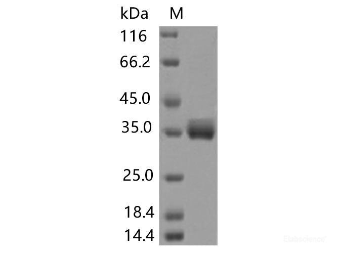 Recombinant SARS-CoV-2 Spike RBD(T385A)(His Tag), Cell Assays, Elabscience Biotechnology, MSE Supplies