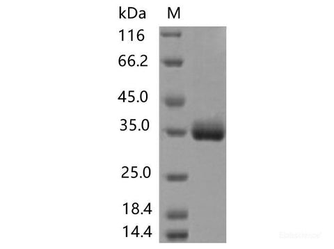 Recombinant SARS-CoV-2 Spike RBD(T393P)(His Tag), Cell Assays, Elabscience Biotechnology, MSE Supplies