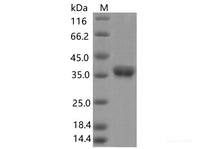 Recombinant SARS-CoV-2 Spike RBD(V395I)(His Tag), Cell Assays, Elabscience Biotechnology, MSE Supplies