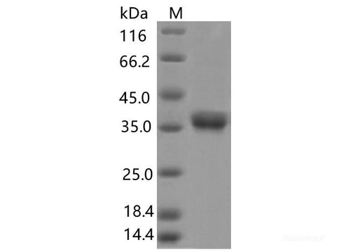 Recombinant SARS-CoV-2 Spike RBD(V395I)(His Tag), Cell Assays, Elabscience Biotechnology, MSE Supplies