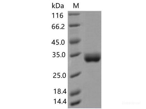 Recombinant SARS-CoV-2 Spike RBD(A475V)(His Tag), Cell Assays, Elabscience Biotechnology, MSE Supplies