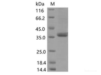 Recombinant SARS-CoV-2 Spike RBD(G482S)(His Tag), Cell Assays, Elabscience Biotechnology, MSE Supplies