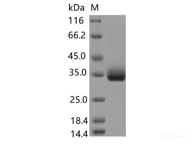Recombinant SARS-CoV-2 Spike RBD(E471Q)(His Tag), Cell Assays, Elabscience Biotechnology, MSE Supplies