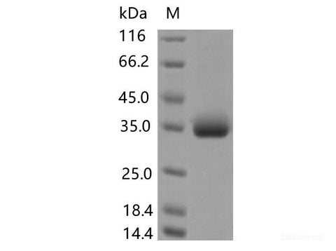 Recombinant SARS-CoV-2 Spike RBD(P479S)(His Tag), Cell Assays, Elabscience Biotechnology, MSE Supplies