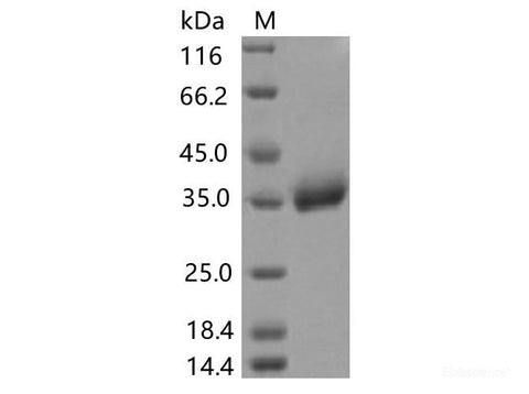 Recombinant SARS-CoV-2 Spike RBD(P521R)(His Tag), Cell Assays, Elabscience Biotechnology, MSE Supplies