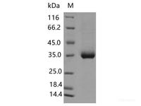 Recombinant SARS-CoV-2 Spike RBD(L455F)(His Tag), Cell Assays, Elabscience Biotechnology, MSE Supplies