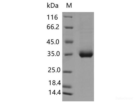 Recombinant SARS-CoV-2 Spike RBD(L455F)(His Tag), Cell Assays, Elabscience Biotechnology, MSE Supplies