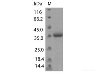 Recombinant SARS-CoV-2 Spike RBD(N481D)(His Tag)