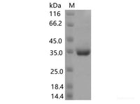 Recombinant SARS-CoV-2 Spike RBD(P499R)(His Tag)