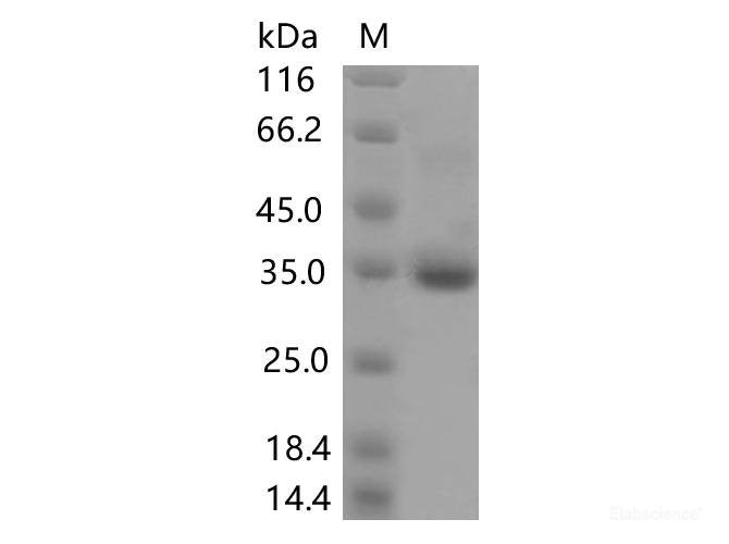 Recombinant SARS-CoV-2 Spike RBD(V445F)(His Tag), Cell Assays, Elabscience Biotechnology, MSE Supplies