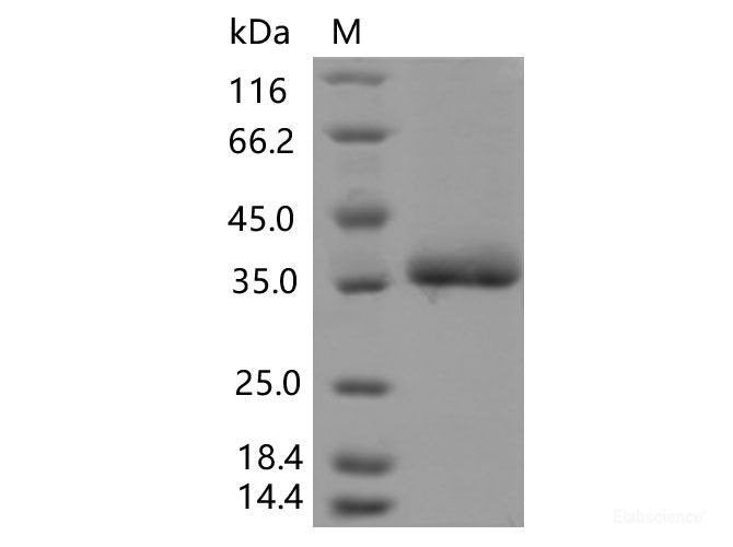 Recombinant SARS-CoV-2 Spike RBD(F490L)(His Tag), Cell Assays, Elabscience Biotechnology, MSE Supplies