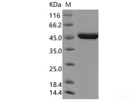 Recombinant SARS-CoV-2 Nucleocapsid Protein (N-His Tag)(Omicron), Cell Assays, Elabscience Biotechnology, MSE Supplies