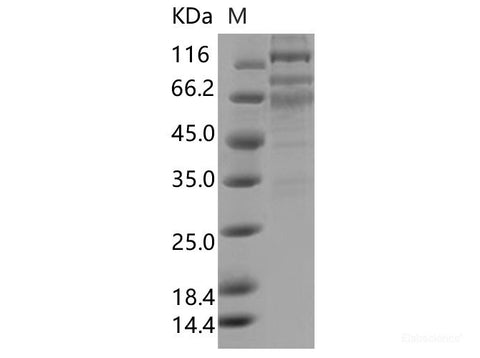 Recombinant SARS-CoV-2 S1+S2 Protein (ECD, C-His Tag)(Omicron), Cell Assays, Elabscience Biotechnology, MSE Supplies