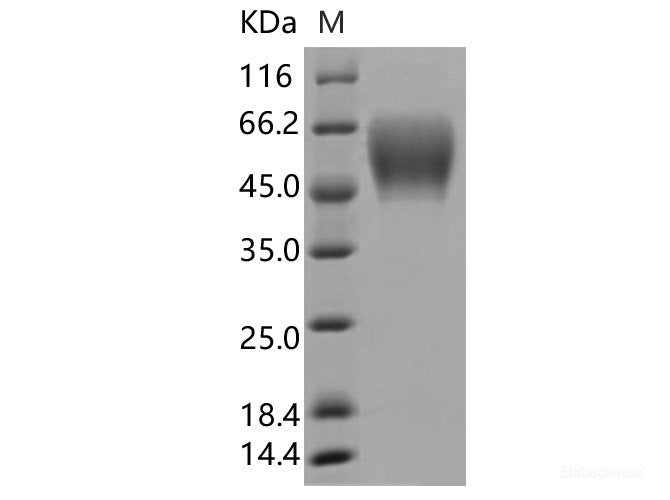 Recombinant SARS-CoV-2 Spike S1 NTD Protein (ECD, C-His Tag)(Omicron), Cell Assays, Elabscience Biotechnology, MSE Supplies