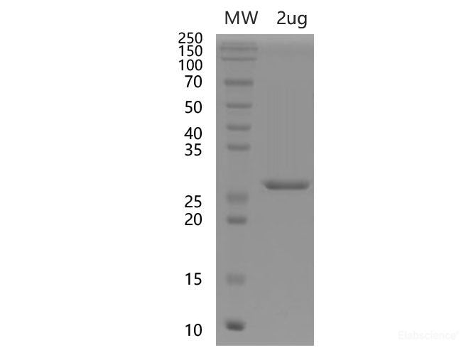 Recombinant SARS-CoV-2 Spike RBD Protein (N-His Tag)(Omicron), Cell Assays, Elabscience Biotechnology, MSE Supplies