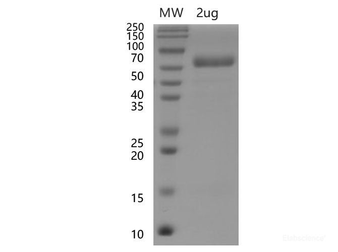 Recombinant SARS-CoV-2 Spike RBD Protein (C-hFc Tag)(Omicron), Cell Assays, Elabscience Biotechnology, MSE Supplies