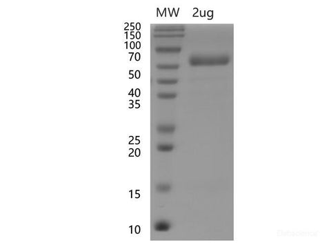 Recombinant SARS-CoV-2 Spike RBD Protein (C-hFc Tag)(Omicron), Cell Assays, Elabscience Biotechnology, MSE Supplies
