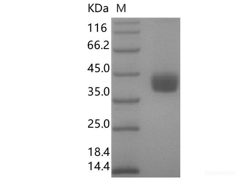 Recombinant SARS-CoV-2 Spike RBD Protein (C-His Tag)(Omicron), Cell Assays, Elabscience Biotechnology, MSE Supplies