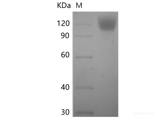 Recombinant SARS-CoV-2 Spike S1 Protein (C-His Tag)(Omicron), Cell Assays, Elabscience Biotechnology, MSE Supplies