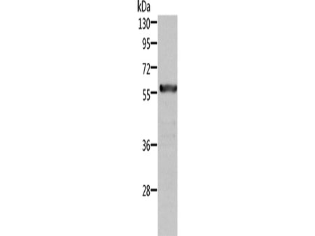 ALDH6A1 Polyclonal Antibody Store at -20°C