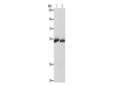 CD36 Polyclonal Antibody Store at -20°C