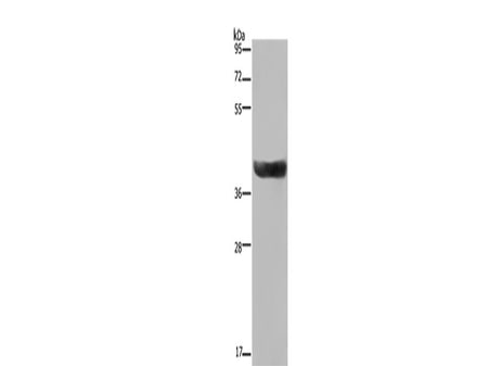 HSD17B2 Polyclonal Antibody Store at -20°C