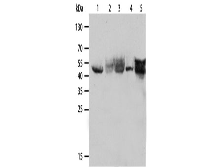 CK-19 Polyclonal Antibody Store at -20°C
