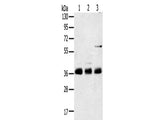 ANKRD1 Polyclonal Antibody