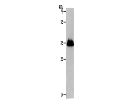 RNF126 Polyclonal Antibody Store at -20°C