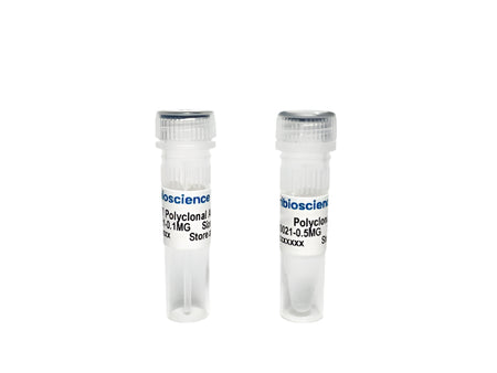 Tribioscience Phospho-Tau Thr217 (p-tau217) Polyclonal Antibody for ELISA, Western Blot and IHC (TBS10021), Biomarkers, Tribioscience, MSE Supplies