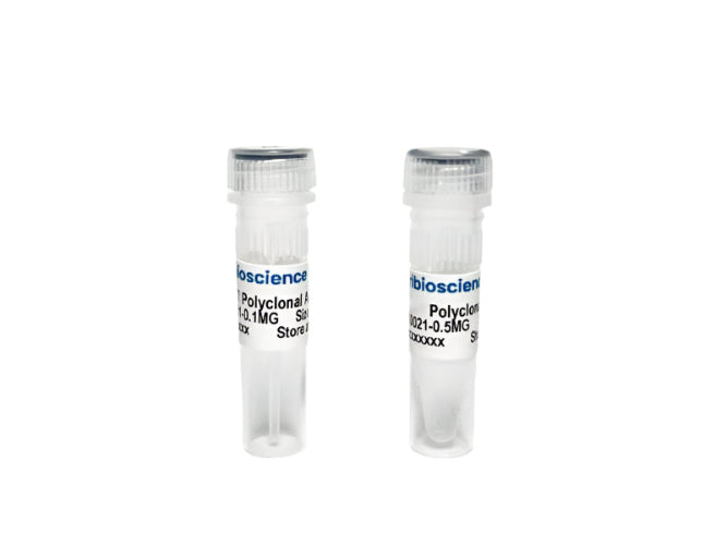 Tribioscience Phospho-Tau Thr181 (p-tau181) Polyclonal Antibody for ELISA, Western Blot and IHC (TBS10033)