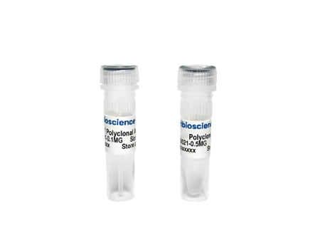 Tribioscience Phospho-Tau Thr181 (p-tau181) Polyclonal Antibody for ELISA, Western Blot and IHC (TBS10033)