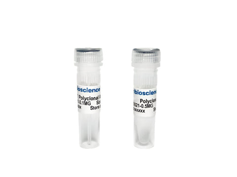 Tribioscience Phospho-Tau Thr181 (p-tau181) Polyclonal Antibody for ELISA, Western Blot and IHC (TBS10033)