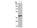 STX16 Polyclonal Antibody Store at -20°C