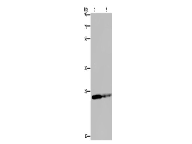 GSTP1 Polyclonal Antibody Store at -20°C