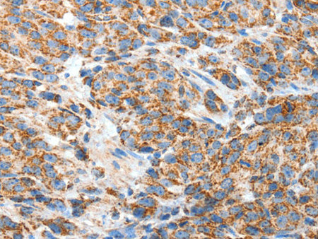 BAK1 Polyclonal Antibody Store at -20°C
