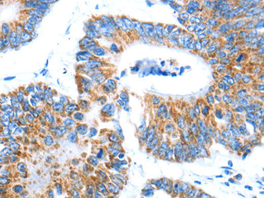 ALDOA Polyclonal Antibody Store at -20°C