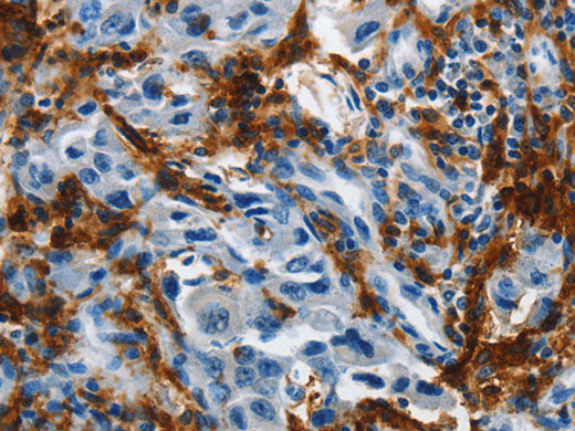 IL20RA Polyclonal Antibody Store at -20°C