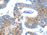 AIFM1 Polyclonal Antibody Store at -20°C