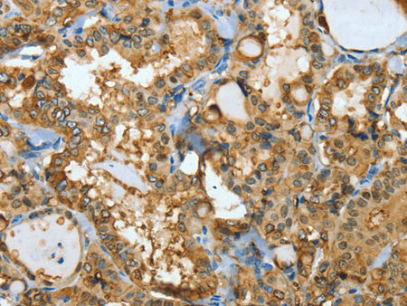 ANXA3 Polyclonal Antibody Store at -20°C