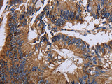 KRT31 Polyclonal Antibody