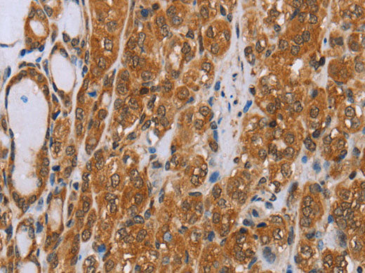 ADAMTS15 Polyclonal Antibody Store at -20°C