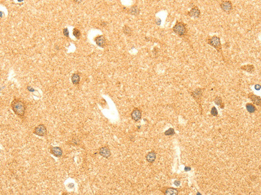 AARS2 Polyclonal Antibody Store at -20°C