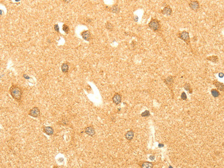 AARS2 Polyclonal Antibody Store at -20°C
