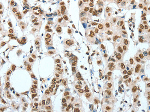 BNIP1 Polyclonal Antibody Store at -20°C