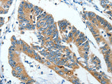 ANGPT1 Polyclonal Antibody Store at -20°C