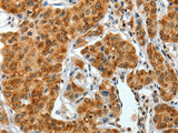 COL1A2 Polyclonal Antibody